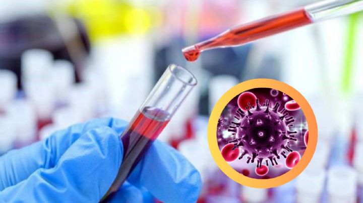 Tras recibir un trasplante de células madre, paciente 'ginebra' se cura de VIH