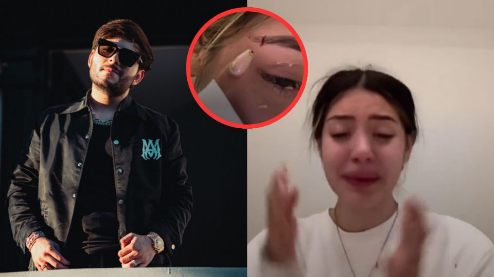 La influencer denunció a integrantes del staff del cantante mexicano por una agresión física
