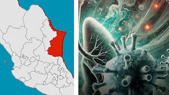 Investigan posible caso de metapneumovirus humano en esta ciudad de Tamaulipas
