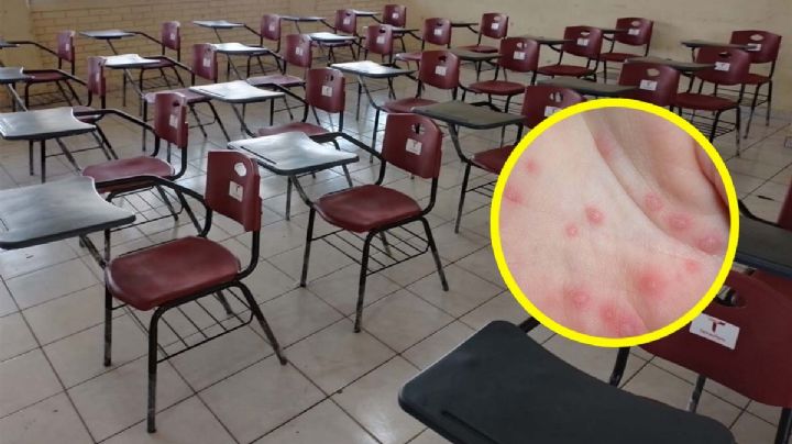 Virus de Coxsackie: confirman primer caso en una estudiante de secundaria en Tamaulipas  