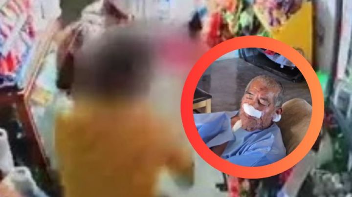 Atacan a machetazos a 'Don Pancho' en su tienda en Nuevo León; su nariz fue mutilada | VIDEO