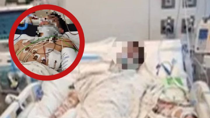 Policía investiga brutal atropellamiento de menor en Laredo; está grave