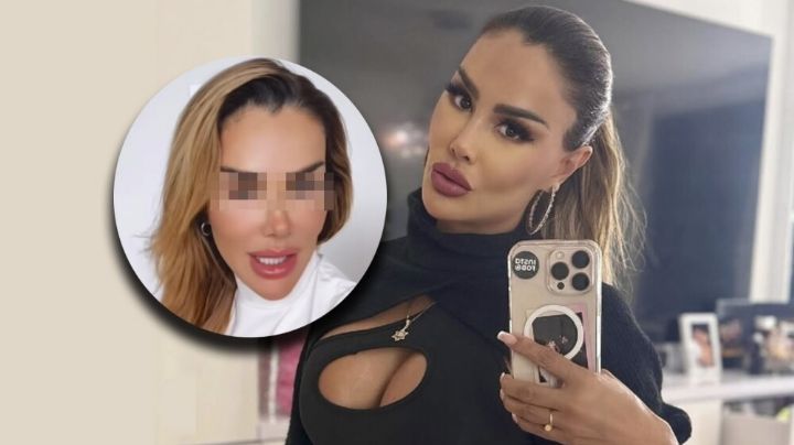 Ninel Conde sorprende con impresionante cambio tras someterse a cirugía estética; ¿qué se operó? | VIDEO