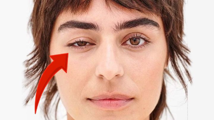¿Por qué algunas personas tienen un ojo más 'cerrado' y cómo se puede revertir?