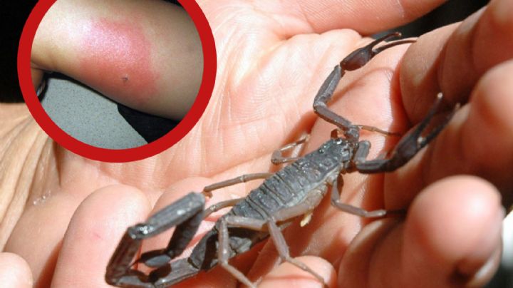 Animales ponzoñosos: alerta en México por picadura de alacrán; reportan 35 casos cada hora