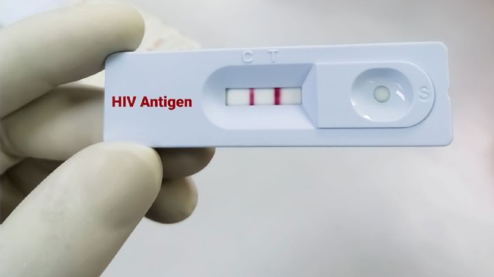 Pruebas gratuitas, anónimas y confidenciales para detectar el VIH; ¿cuándo y en dónde?
