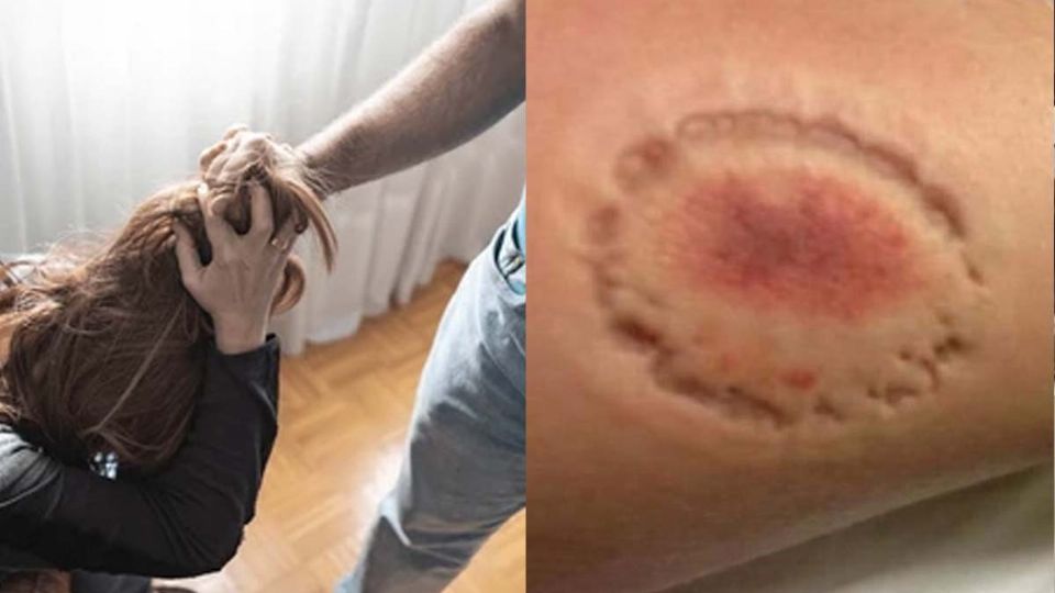 La joven fue violentada por su novio