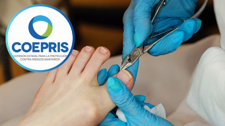 Atención podológica sin control puede causar amputaciones; Coepris emite alerta en Tamaulipas