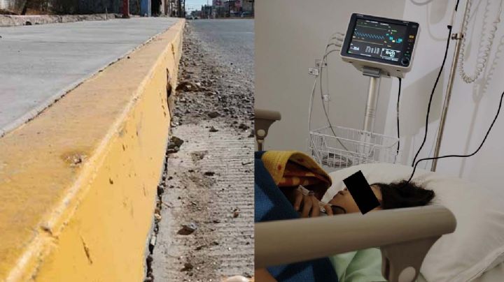 ¡Melody salió de cirugía!; es la niña de Nuevo Laredo que se cayó al salir de su escuela