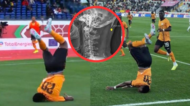 Futbolista cae sobre su cuello al realizar un mal movimiento; este es su estado de salud | VIDEO