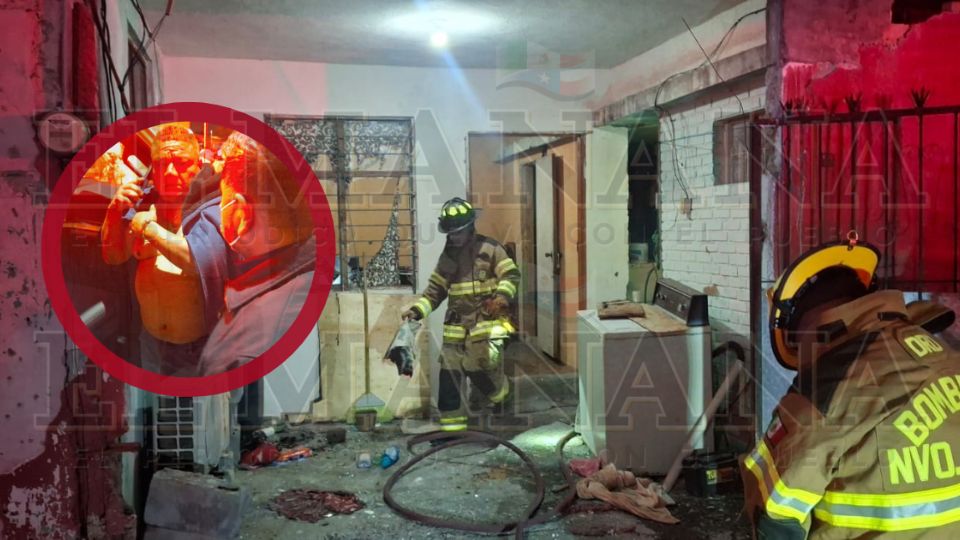 Eduardo quedó con quemaduras de primero, segundo y tercer grado.