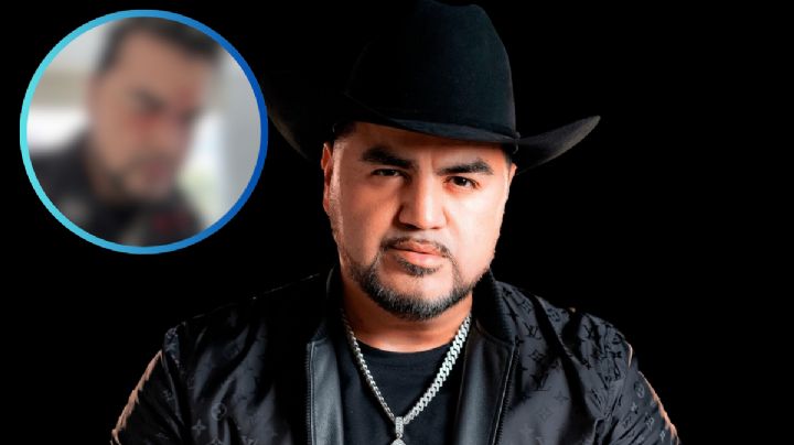 ‘El Mimoso’ preocupa a fans por fotografía con golpes en el rostro; ¿qué le pasó?
