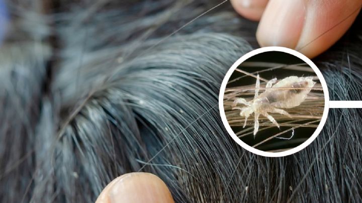 Piojos: estos son los peinados más efectivos para evitar un contagio