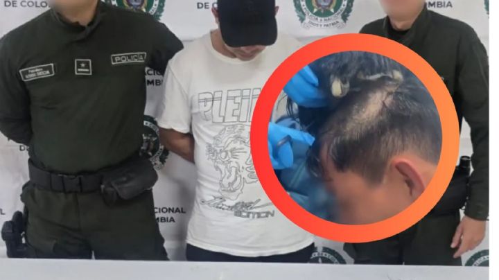 Capturan a hombre con 'polvo blanco' oculto en una 'narcopeluca' en un aeropuerto | VIDEO