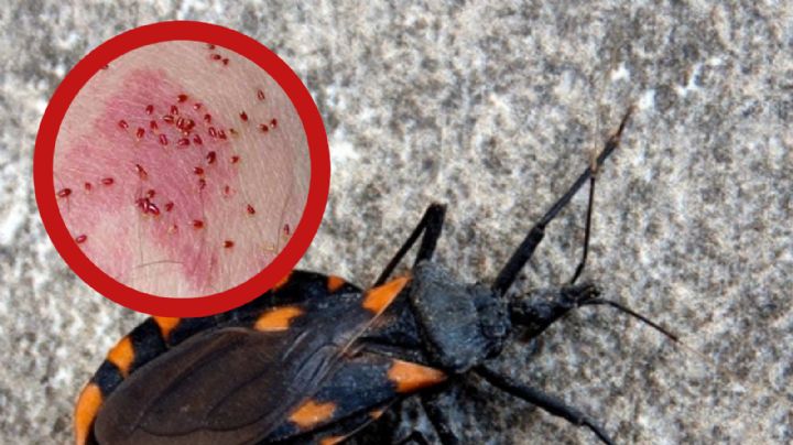 Chinche besucona: ¿dónde se esconde y por qué es tan peligrosa?