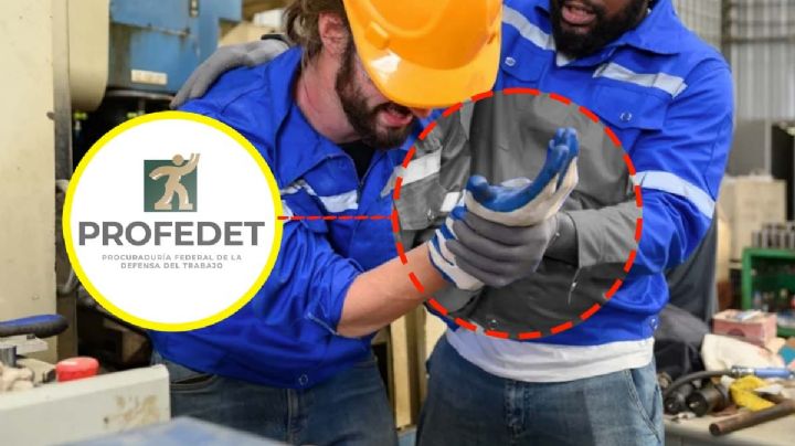 LFT: si pierdes dedos de la mano trabajando, ¿cómo te deberían de indemnizar según la ley?