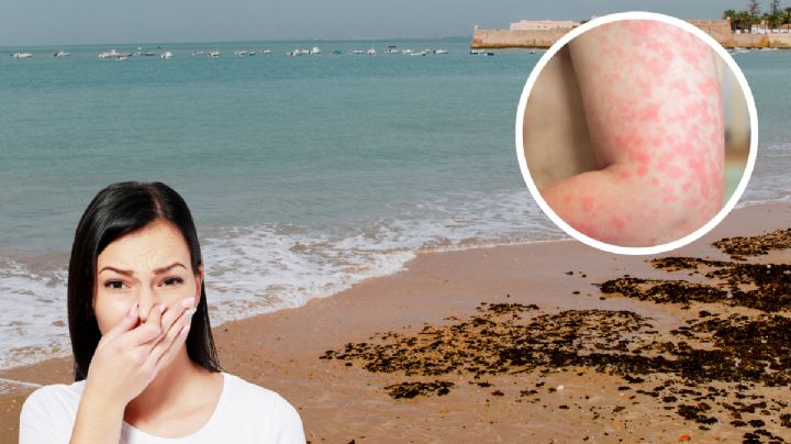 Semana Santa: estas enfermedades puedes contraer si visitas una de las playas más sucias en México