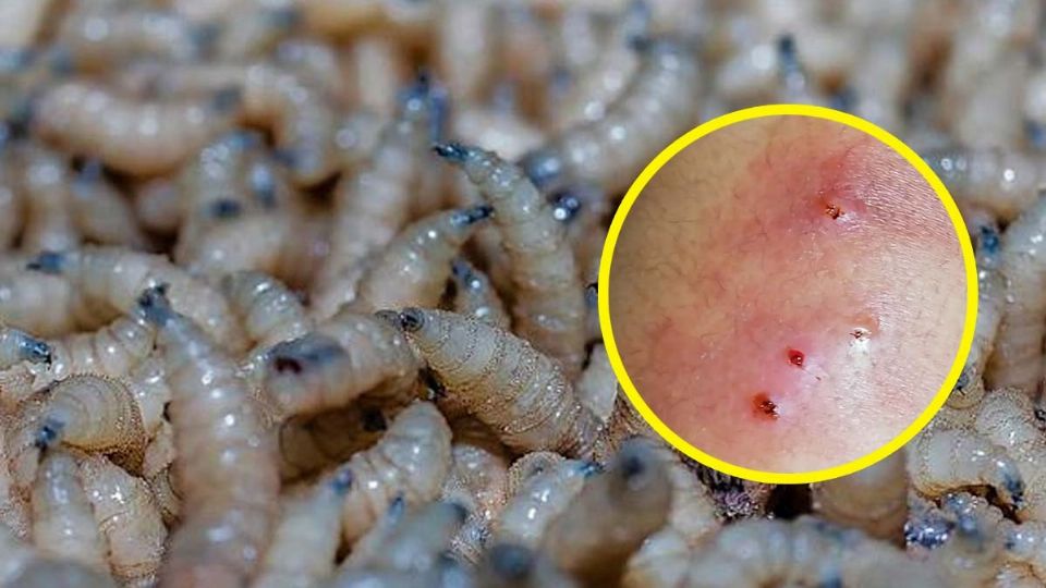 Enfermedad que amenaza a los humanos