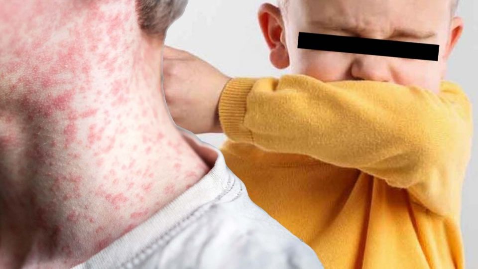 Invitan a vacunarse para evitar enfermedades respiratorias