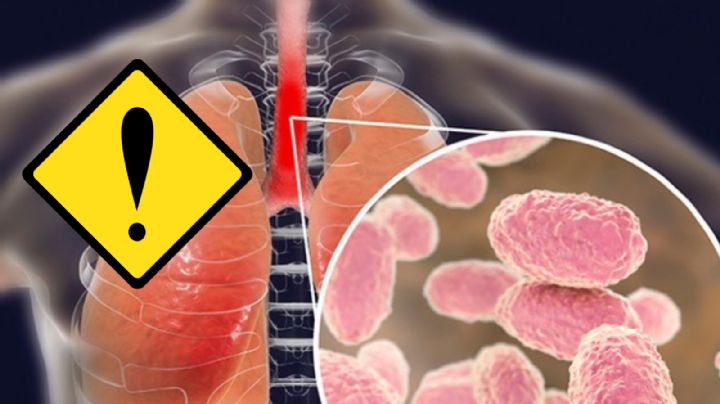 Tamaulipas: aumentan casos de tosferina en el estado; esta es la cifra