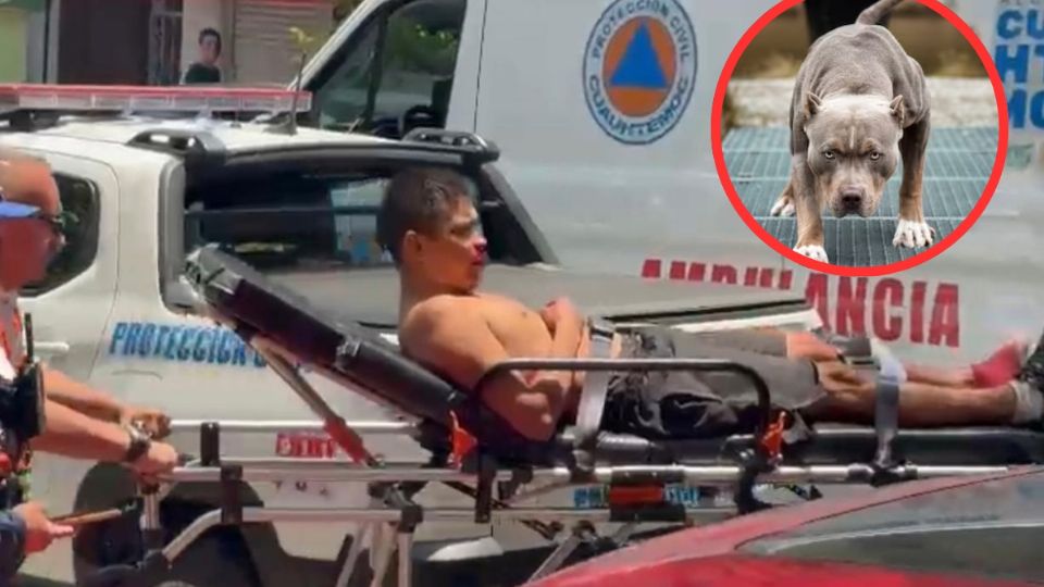 Servicios de emergencia tuvieron que rescatar al hombre ante el ataque de sus propios perros