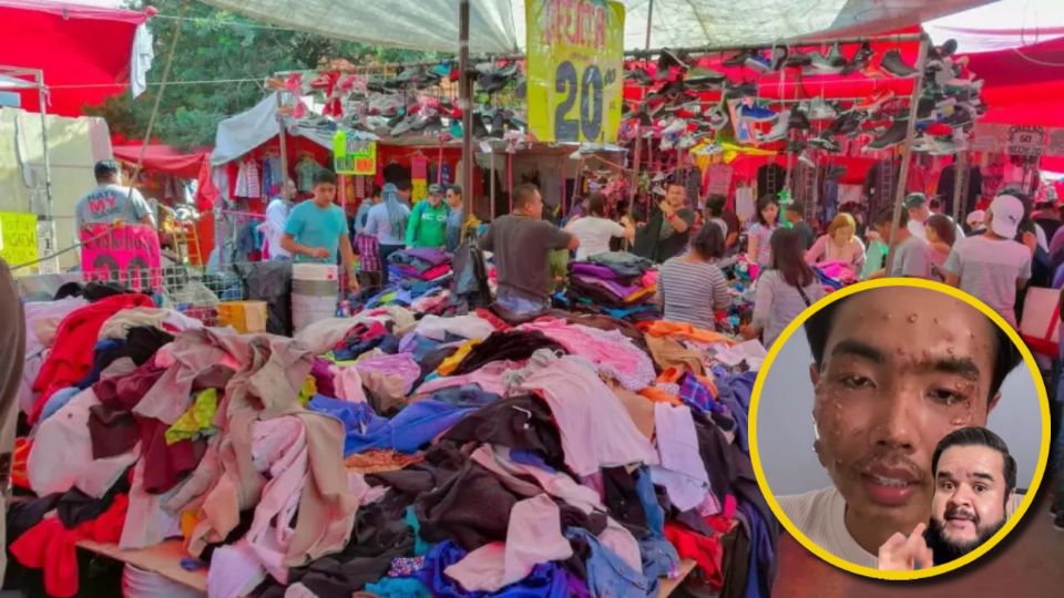 Los niños, adultos mayores, y personas con el sistema inmunológico comprometido, son los más propensos a contraer enfermedades al utilizar prendas de segunda mano