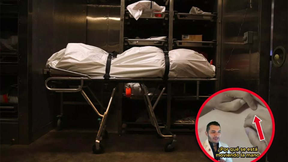 Los pensamientos sobrenaturales en este ámbito fueron desmentidos por el profesional, dando a conocer las condiciones en las que un cuerpo muerto podría simular un movimiento