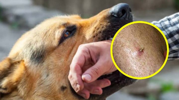 Gusano barrenador en México: ya son dos personas reportadas con miasis; ¿hay cura?