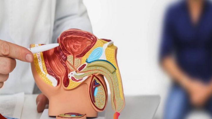 Suben casos por cáncer de próstata en Nuevo Laredo