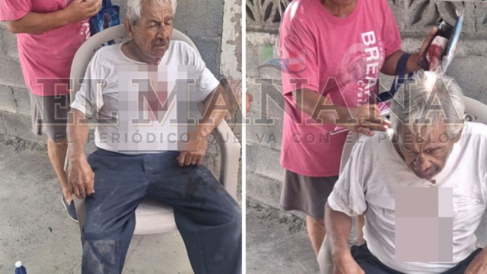 El abuelito fue trasladado a un hospital.