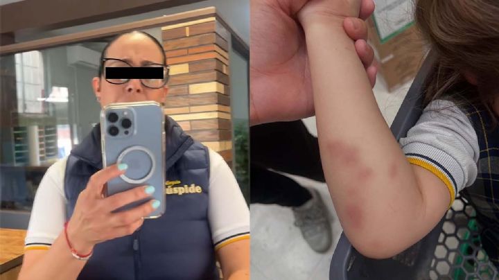 Mujer exhibe en TikTok que su hija de 4 años sufre bullying en la escuela; 'así me la entregaron' 