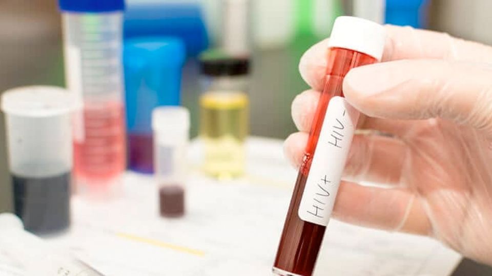 Prubas gratis de detección de HIV.