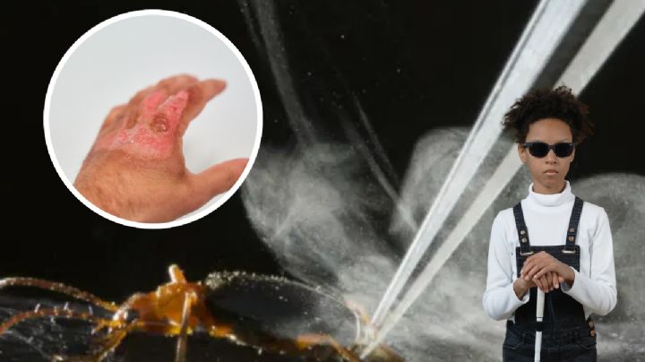 Este 'indefenso' escarabajo podría dejarte ciego; arroja ácido hirviendo | VIDEO