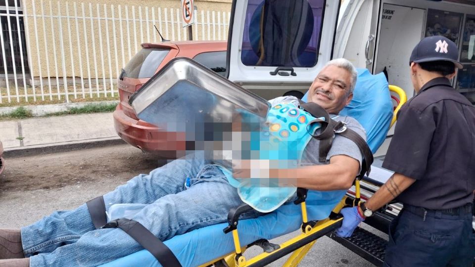 Los médicos hicieron lo posible por salvarle los dedos de su mano.