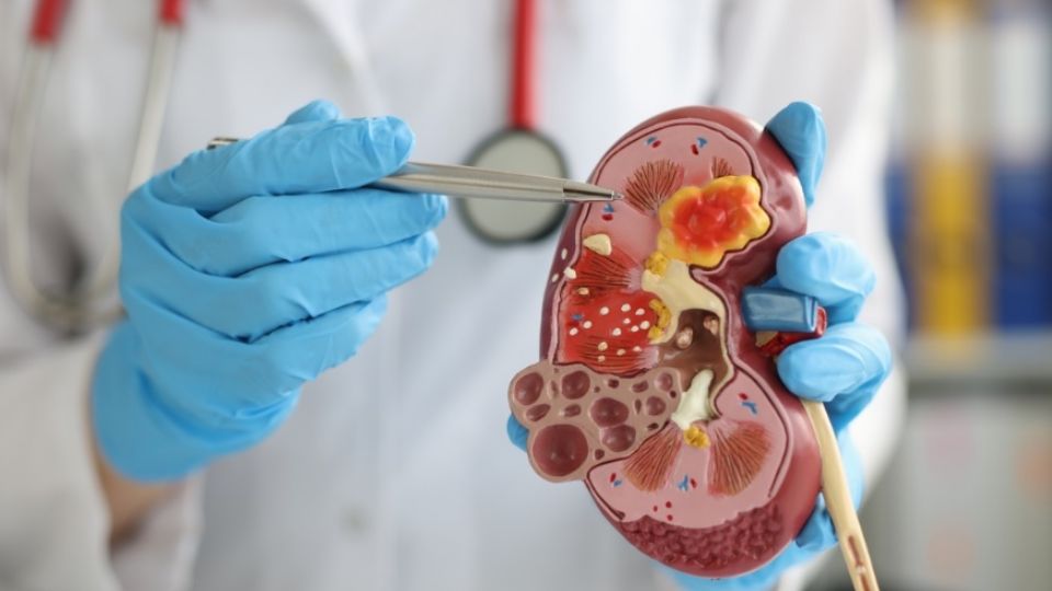 Los trasplantes salvan vidas.