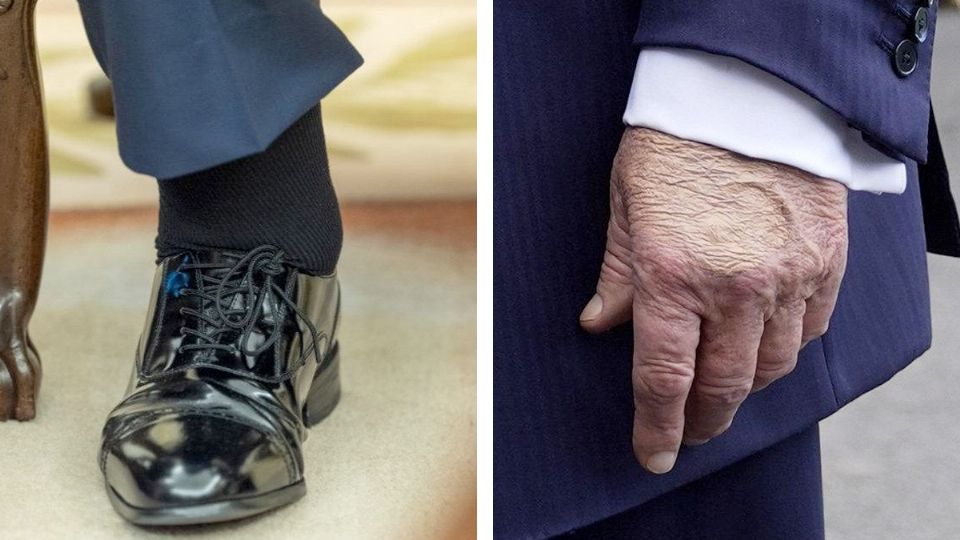 La enfermedad del presidente.