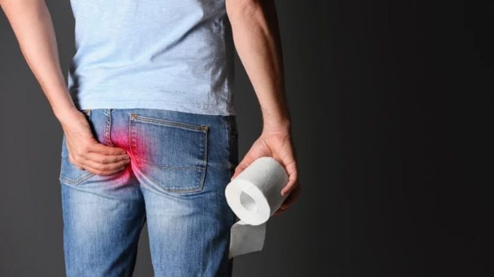 ¿Qué son las hemorroides y cómo eliminarlas de manera natural?