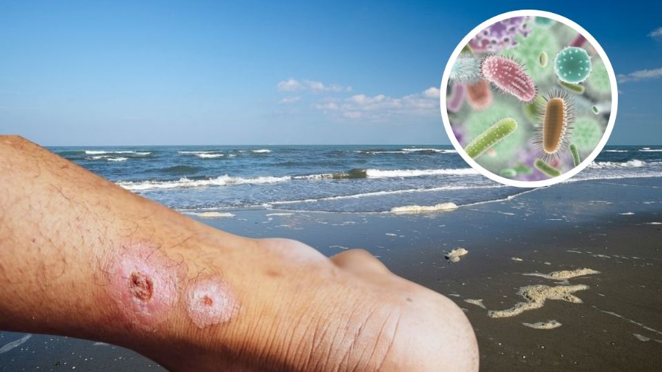 Esta es la lista de las playas que podrían provocarte enfermedades