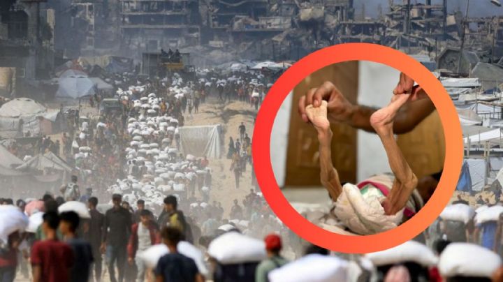 Muere de hambre bebé de 5 meses en Gaza; pesaba menos de 2 kilos