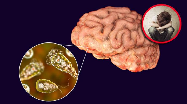 Niño de 12 años muere tras infectarse con rara amiba 'comecerebros'