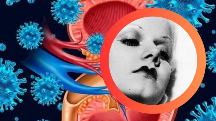 Era la estrella más deseada de Hollywood, hasta que su salud la traicionó; murió hinchada