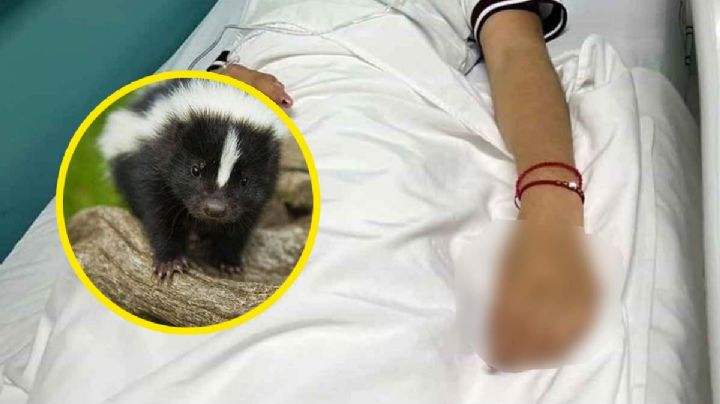 Joven que fue infectada de rabia murió en el hospital; así fueron sus últimos momentos