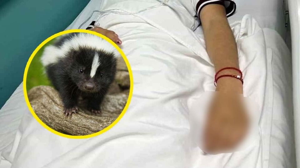 Muerte por rabia en México