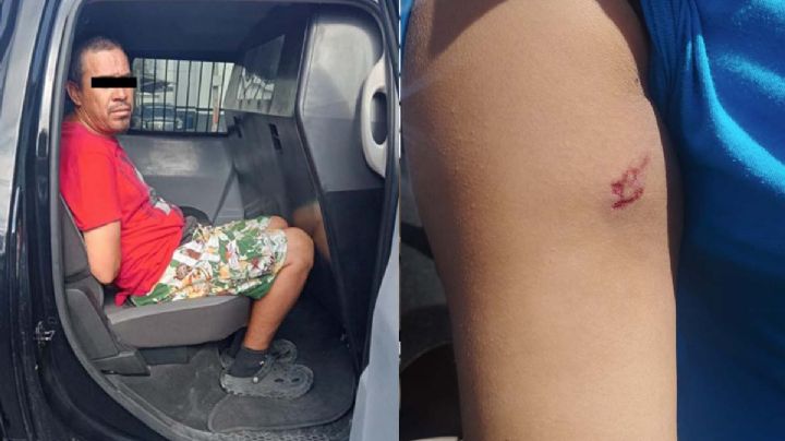 Cliente se enoja y muerde a empleada porque no tenía sistema para hacerle una recarga en Monterrey 
