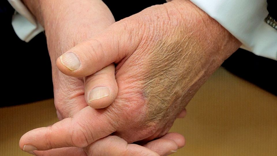 La ausencia de Trump promovió rumores acerca de su salud