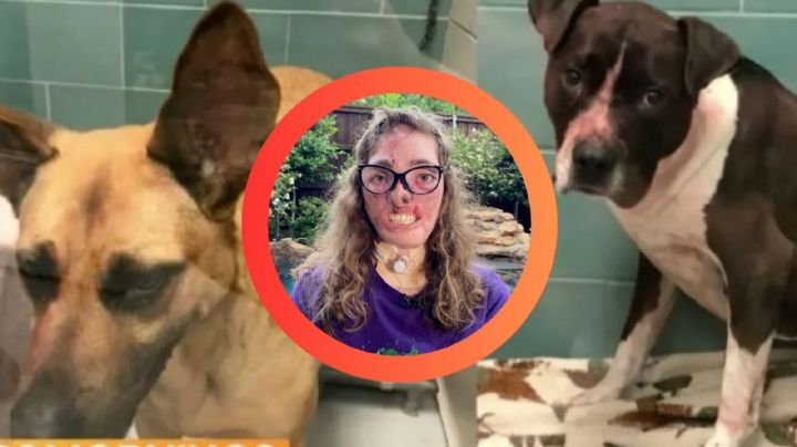 Mujer fue a cuidar unos perros y le arrancaron las orejas, nariz y labios; recibió 800 mordeduras