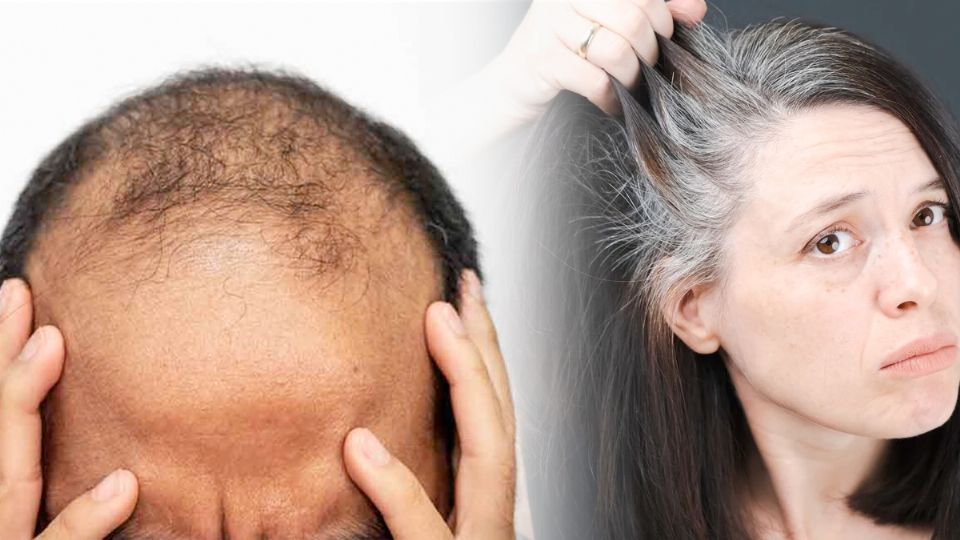 Una causa más para la aparición calvicie y aparición de canas