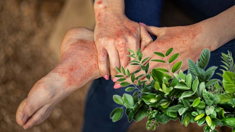 Plantas tóxicas en el jardín