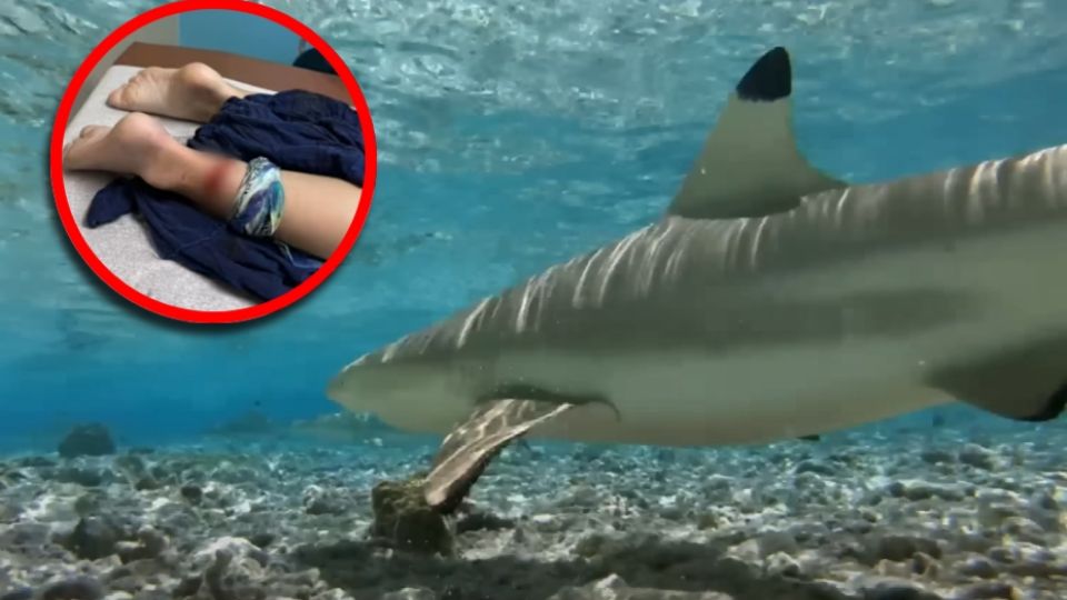 Según el International Shark Attack File de la Universidad de Florida, la mayoría de los casos en Estados Unidos ocurren en playas de Florida