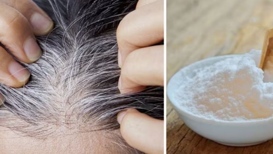 Más que buscar remedios milagrosos, prioriza un estilo de vida saludable: alimentación rica en vitaminas E y D, manejo del estrés y cuidado profesional de tu cabello